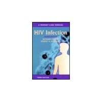 HIV Infection: A Primary Care Manual HIV Infection: A Primary Care Manual Paperback