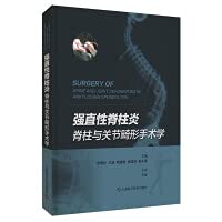 Ankylosing Spondylitis Spine and Joint Deformity Surgery(Chinese Edition)