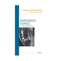 Imaging of Osteoarthritis, An Issue of Radiologic Clinics of North America (Volume 47-4) (The Clinics: Radiology, Volume 47-4)