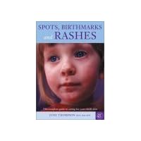 Spots, Birthmarks and Rashes: The Complete Guide to Caring for Your Child's Skin Spots, Birthmarks and Rashes: The Complete Guide to Caring for Your Child's Skin Paperback