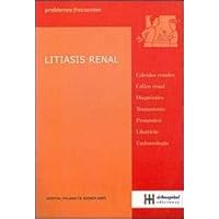 Litiasis renal / Kidney Stones (Problemas frecuentes / Common Problems) (Spanish Edition)