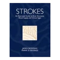 Strokes: An Illustrated Guide to Brain Structure, Blood Supply and Clinical Signs Strokes: An Illustrated Guide to Brain Structure, Blood Supply and Clinical Signs Paperback