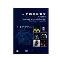 Myocardial infarction complications - clinical diagnosis map(Chinese Edition)
