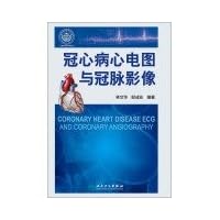 ECG and coronary imaging of coronary heart disease(Chinese Edition)