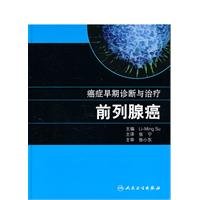 early diagnosis and treatment of cancer: prostate cancer(Chinese Edition)