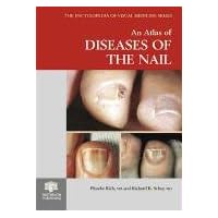 An Atlas of Diseases of the Nail (Encyclopedia of Visual Medicine Series) An Atlas of Diseases of the Nail (Encyclopedia of Visual Medicine Series) Hardcover Kindle