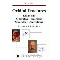 Orbital Fractures: Diagnosis, Operative Treatment, Secondary Corrections Orbital Fractures: Diagnosis, Operative Treatment, Secondary Corrections Hardcover