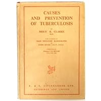 Causes and Prevention of Tuberculosis