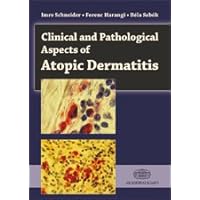 Clinical and Pathological Aspects of Atopic Dermatitis