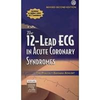 T.Phalen's B. J Aehlert RN BSPA's The 12-Lead ECG in Acute Coronary 2nd(Second) edition(The 12-Lead ECG in Acute Coronary Syndromes Text and Pocket Reference Package - Revised Reprint [Paperback)(2006) T.Phalen's B. J Aehlert RN BSPA's The 12-Lead ECG in Acute Coronary 2nd(Second) edition(The 12-Lead ECG in Acute Coronary Syndromes Text and Pocket Reference Package - Revised Reprint [Paperback)(2006) Paperback