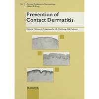 Prevention of Contact Dermatitis (Current Problems in Dermatology) Prevention of Contact Dermatitis (Current Problems in Dermatology) Hardcover