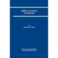 Medical Image Databases (The Springer International Series in Engineering and Computer Science Book 465) Medical Image Databases (The Springer International Series in Engineering and Computer Science Book 465) Kindle Hardcover Paperback
