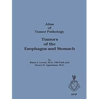 Tumors of the Esophagus & Stomach (Atlas of Tumor Pathology, 3rd Series, Vol. 18) Tumors of the Esophagus & Stomach (Atlas of Tumor Pathology, 3rd Series, Vol. 18) Paperback