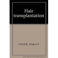 Hair transplantation Hair transplantation Hardcover Paperback