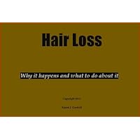 Hair Loss: Why it happens and what to do about it Hair Loss: Why it happens and what to do about it Kindle