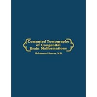 Computed Tomography of Congenital Brain Malformations Computed Tomography of Congenital Brain Malformations Kindle Hardcover