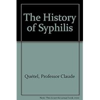 The History of Syphilis The History of Syphilis Hardcover Paperback