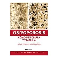 Osteoporosis, Como Detectarla Y Tratarla/ Osteoporosis, How to Detect and Treat It (Colleccion El Mundo De La Salud) (Spanish Edition)