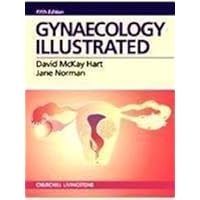 Gynecology Illustrated Gynecology Illustrated Paperback
