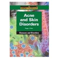 Acne and Skin Disorders (Compact Research: Drugs) Acne and Skin Disorders (Compact Research: Drugs) Library Binding