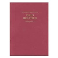 Virus hepatitis : the Harveian oration delivered before the Fellows of the Royal College of Physicians of London on Thursday 17th October 1985 / by Dame Sheila Sherlock Virus hepatitis : the Harveian oration delivered before the Fellows of the Royal College of Physicians of London on Thursday 17th October 1985 / by Dame Sheila Sherlock Paperback