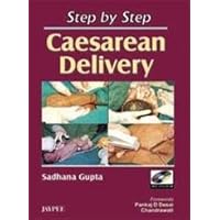 Step by Step Caesarean Delivery with DVD-ROM Step by Step Caesarean Delivery with DVD-ROM Paperback