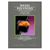 Nasal Polyposis: An Inflammatory Disease and Its Treatment Nasal Polyposis: An Inflammatory Disease and Its Treatment Hardcover