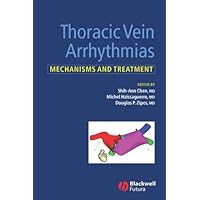 Thoracic Vein Arrhythmias: Mechanisms and Treatment Thoracic Vein Arrhythmias: Mechanisms and Treatment Kindle Hardcover