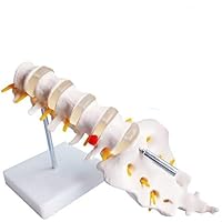 DR Human 1:1 Mini Lumbar Vertebrae with Sacrum Coccyx and Herniated Disc Joint Simulation.