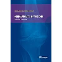Osteoarthritis of the knee Osteoarthritis of the knee Kindle Paperback Mass Market Paperback