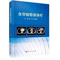 Precise diagnosis and treatment of esophageal cancer(Chinese Edition)