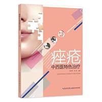 The characteristics of traditional Chinese and western medicine treatment of acne(Chinese Edition)