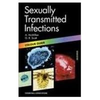 Sexually Transmitted Diseases: Colour Guide (Colour Guides) Sexually Transmitted Diseases: Colour Guide (Colour Guides) Paperback