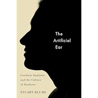 The Artificial Ear: Cochlear Implants and the Culture of Deafness The Artificial Ear: Cochlear Implants and the Culture of Deafness Kindle Hardcover Paperback