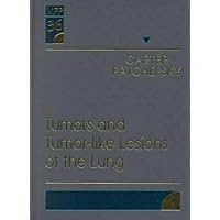 Tumors and Tumor-Like Lesions of the Lung Tumors and Tumor-Like Lesions of the Lung Hardcover