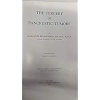 Surgery of Pancreatic Tumors Surgery of Pancreatic Tumors Hardcover
