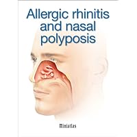 Allergic rhinitis and nasal polyposis Miniatlas Allergic rhinitis and nasal polyposis Miniatlas Kindle