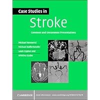 Case Studies in Stroke: Common and Uncommon Presentations (Case Studies in Neurology) Case Studies in Stroke: Common and Uncommon Presentations (Case Studies in Neurology) Kindle Paperback