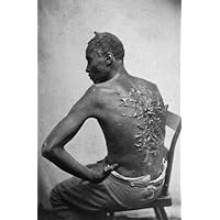 ConversationPrints SCARS OF A WHIPPED SLAVE GLOSSY POSTER PICTURE PHOTO PRINT us black slavery