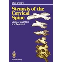 Stenosis of the Cervical Spine: Causes, Diagnosis and Treatment Stenosis of the Cervical Spine: Causes, Diagnosis and Treatment Kindle Hardcover Paperback