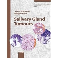 Salivary Gland Tumours: Monographs in Clinical Cytology Salivary Gland Tumours: Monographs in Clinical Cytology Hardcover
