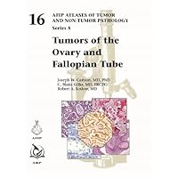 Tumors of the Ovary and Fallopian Tube