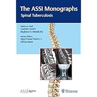 The ASSI Monographs—Spinal Tuberculosis The ASSI Monographs—Spinal Tuberculosis Hardcover