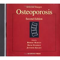 Osteoporosis, CD-ROM