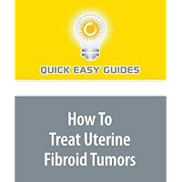 How To Treat Uterine Fibroid Tumors