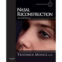 Nasal Reconstruction: Art and Practice Nasal Reconstruction: Art and Practice Kindle