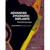 Advanced Zygomatic Implants: The Zaga Concept Advanced Zygomatic Implants: The Zaga Concept Hardcover Kindle