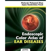 Endoscopic Color Atlas of Ear Diseases Endoscopic Color Atlas of Ear Diseases Hardcover