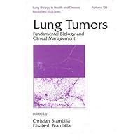 Lung Tumors: Fundamental Biology and Clinical Management (Lung Biology in Health and Disease) Lung Tumors: Fundamental Biology and Clinical Management (Lung Biology in Health and Disease) Hardcover