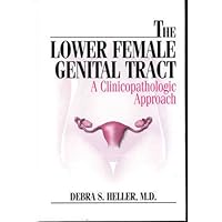 The Lower Female Genital Tract: A Clinicopathologic Approach The Lower Female Genital Tract: A Clinicopathologic Approach Hardcover